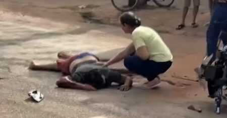 Motociclista colide com caminhonete e acaba com fraturas expostas no Hospital Municipal; vídeo