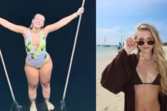 Lauren Pfeiff detalha impactos e recuperação um ano após cirurgia de lipedema