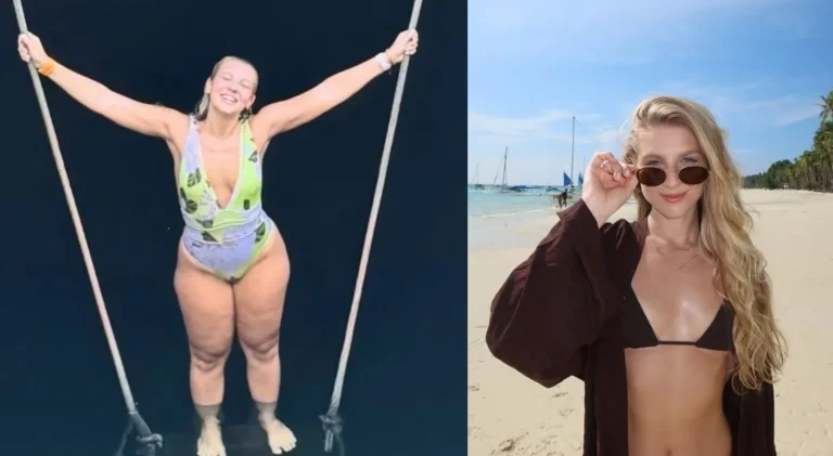 Lauren Pfeiff detalha impactos e recuperação um ano após cirurgia de lipedema
